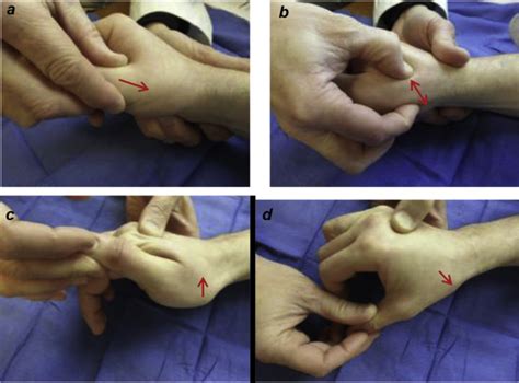 metacarpal compression test|thumb carpometacarpal joint test.